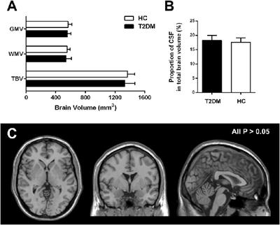 Alterations of White Matter Integrity and Hippocampal Functional Connectivity in Type 2 Diabetes Without Mild Cognitive Impairment